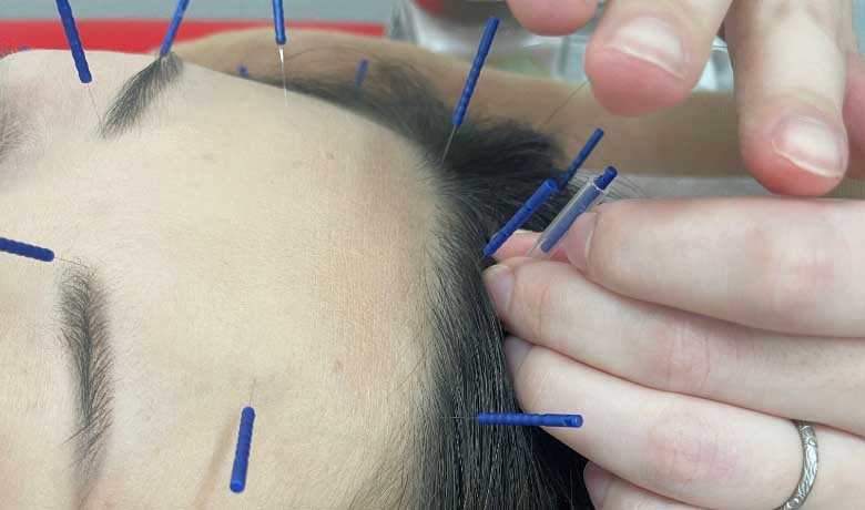 該当治療の写真